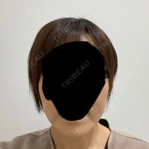 92 days after image