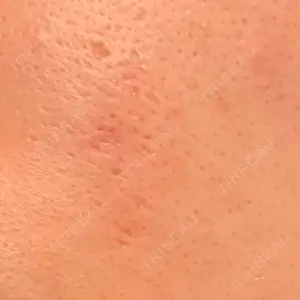11 days after image