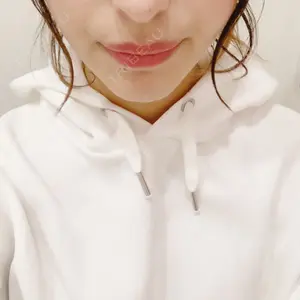 32 days after image