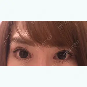 28 days after image