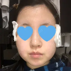 8 days after image