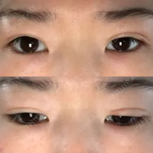 14 days after image