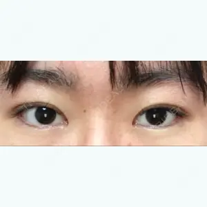94 days after image