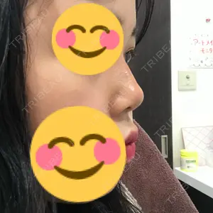 28 days after image