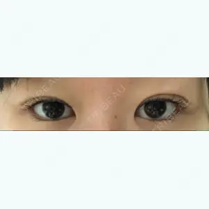 5 days after image