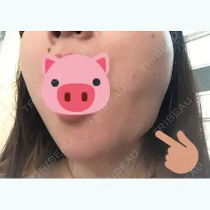 湘南美容クリニック大阪あべの院の吉田公人医師口コミ