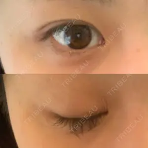 68 days after image