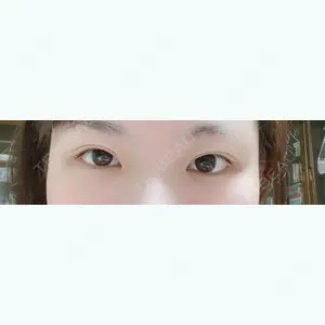 141 days after image