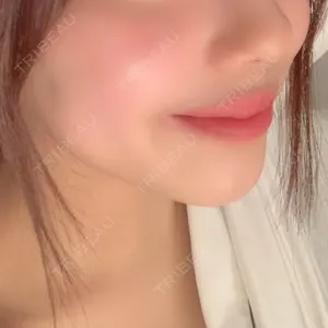 口コミ