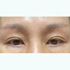 31 days after image