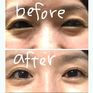 77 days after image