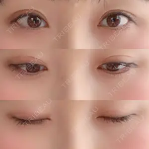 12 days after image