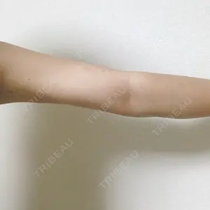 34 days after image