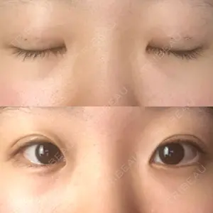 6 days after image