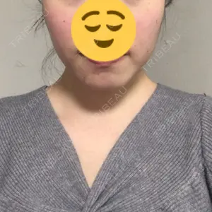 34 days after image