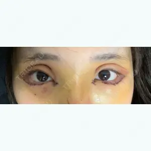3 days after image