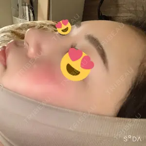53 days after image