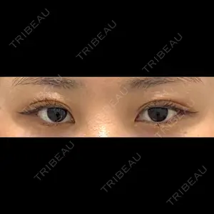 31 days after image