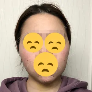 4 days after image