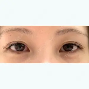 3 days after image