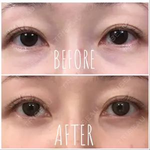 63 days after image