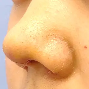 4 days after image