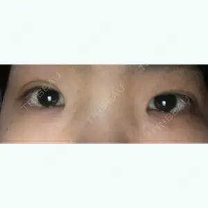 40 days after image