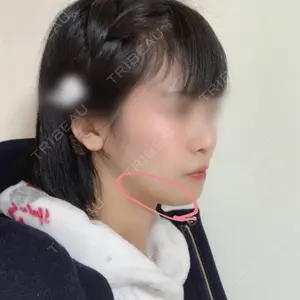 184 days after image