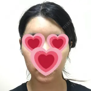 23 days after image