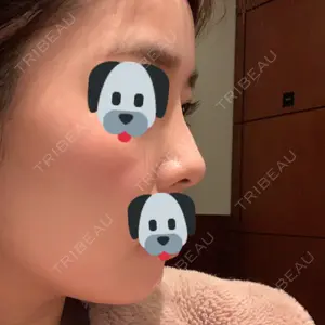 7 days after image