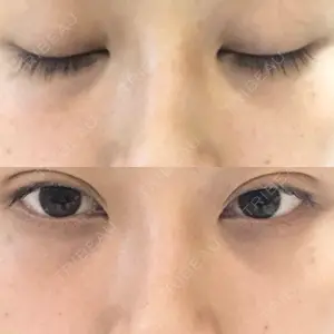 18 days after image