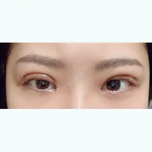 13 days after image
