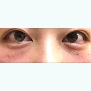9 days after image