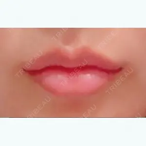 0 days after image