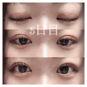 5 days after image