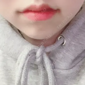 0 days after image