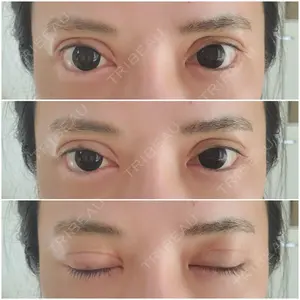ララ整形外科口コミ