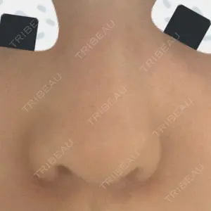 16 days after image
