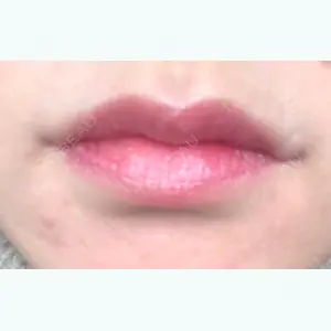 24 days after image
