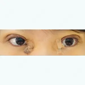 4 days after image