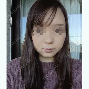 25 days after image