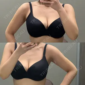 7 days after image