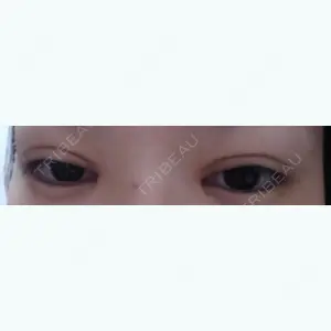 57 days after image