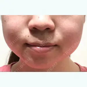 8 days after image