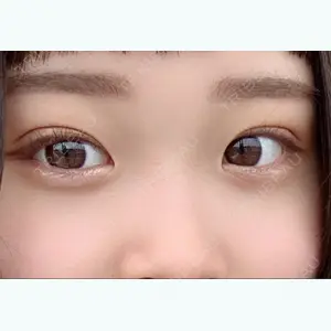 4 days after image