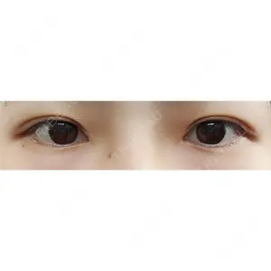 113 days after image