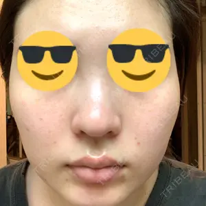 25 days after image