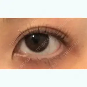 93 days after image