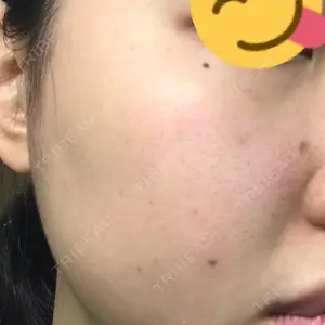 7 days after image