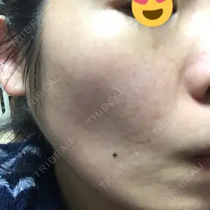 7 days after image